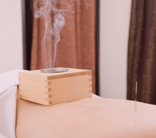 moxibustion en la consulta de la dra laura navardun en zaragoza